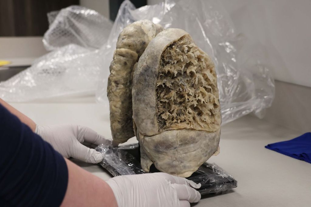 Human hands wearing protective gloves steady a display of plastinated human lungs.