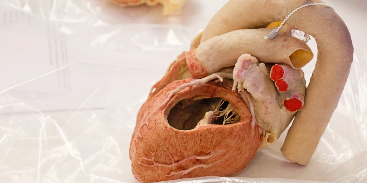 Heart close-up.
